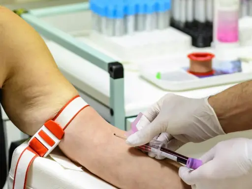 Wysokie żelazo w surowicy? Zrozum wyniki i chroń zdrowie